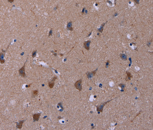 TUBGCP2 Polyclonal Antibody – Figure 1 of 3