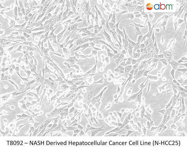 NASH Derived Hepatocellular Cancer Cell Line (N-HCC25) | Applied Biological Materials (abm)