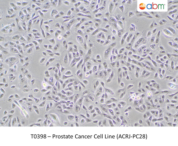 Prostate Cancer Cell Line (ACRJ-PC28) – Figure 1 of 1