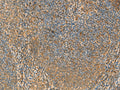 PPP1R1A Polyclonal Antibody – Figure 1 of 3