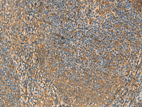 PPP1R1A Polyclonal Antibody – Figure 1 of 3