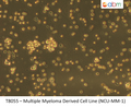 Multiple Myeloma Derived Cell Line (NCU-MM-1) | Applied Biological Materials (abm)