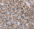 KCNJ11 Polyclonal Antibody – Figure 1 of 2