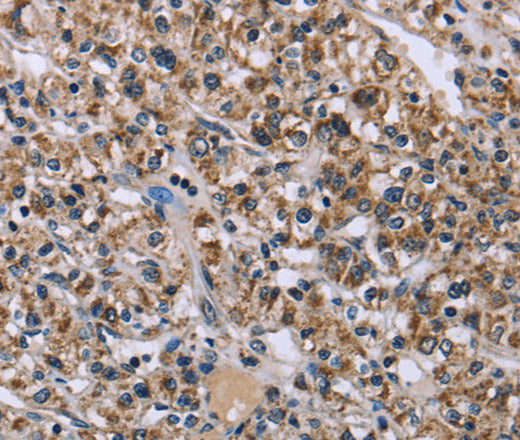 KCNJ11 Polyclonal Antibody – Figure 1 of 2