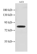 GUSB Polyclonal Antibody – Figure 1 of 2