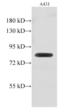 GUSB Polyclonal Antibody – Figure 1 of 2
