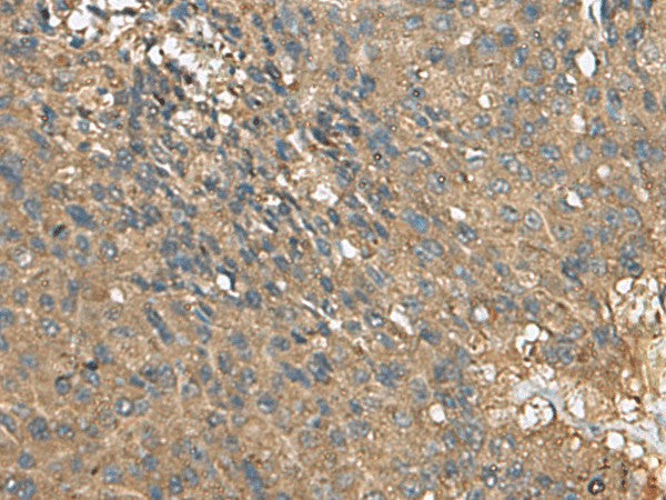 EIF1AX Polyclonal Antibody – Figure 1 of 3