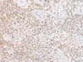 SMNDC1 Polyclonal Antibody – Figure 1 of 2
