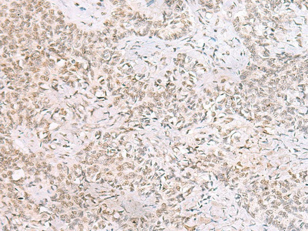 SMNDC1 Polyclonal Antibody – Figure 1 of 2