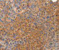 NOD1 Polyclonal Antibody – Figure 1 of 3