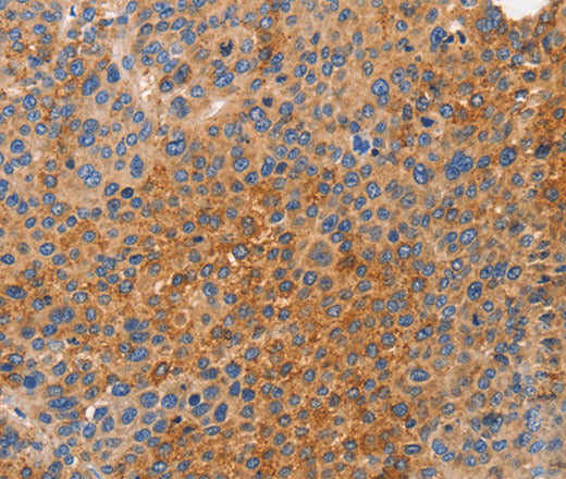 NOD1 Polyclonal Antibody – Figure 1 of 3