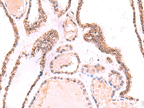 TOR1AIP1 Polyclonal Antibody – Figure 1 of 2