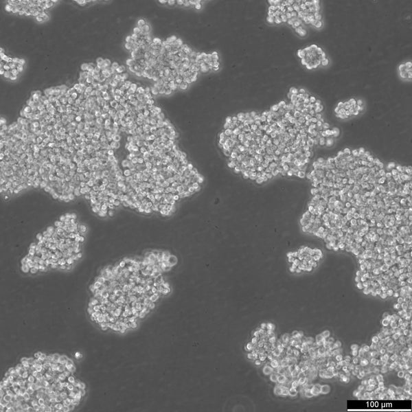 Y-79 cell