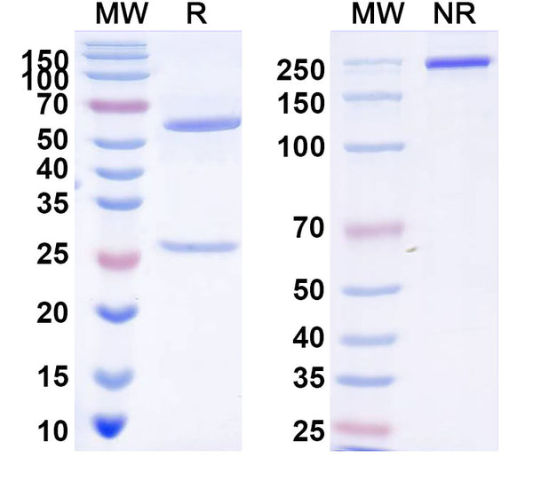 SDS-PAGE for Anti-EDTA chelate of indium (metal chelate) Antibody (CHA255)