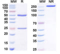 SDS-PAGE for Anti-T3/Liothyronine Antibody (SAA2030).