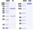 SDS-PAGE for Anti-T3/Liothyronine Antibody (SAA2031).