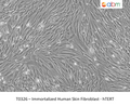 Immortalized Human Skin Fibroblast - hTERT | Applied Biological Materials (abm)