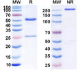 Anti-Staphylococcus Epidermidis Lipoteichoic Acid Reference Antibody (Pagibaximab) – Figure 1 of 1
