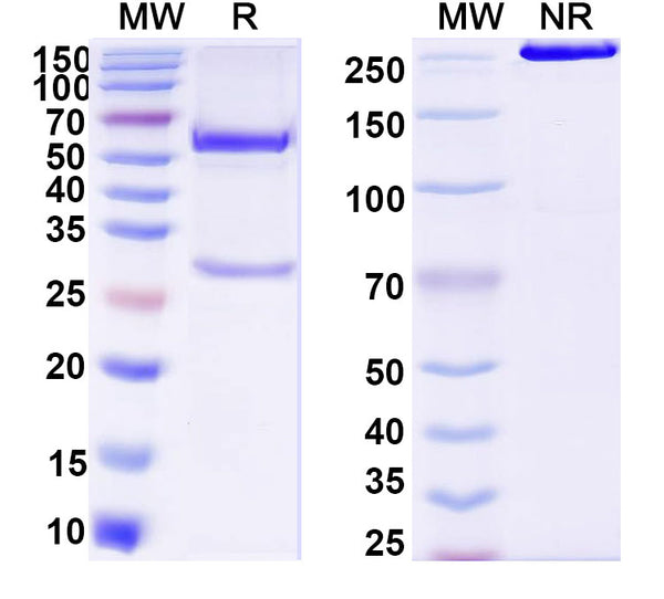 SDS-PAGE for Anti-DNA Antibody (O81)