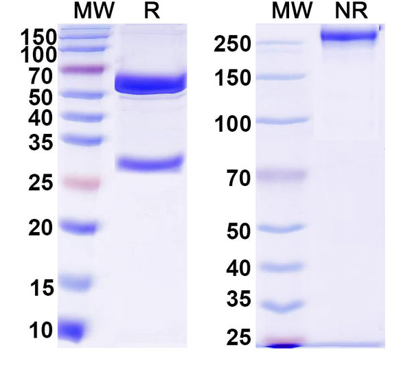 SDS-PAGE for Anti-DNA Antibody (MRL-10)
