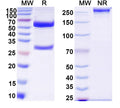 SDS-PAGE for Anti-DNA Antibody (bfd89)