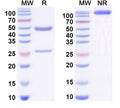 SEC-HPLC detection for Anti-DNA Antibody (11F8).