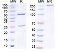 SDS-PAGE for Anti-Ganglioside GD2 Antibody (AB527)