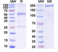 SDS-PAGE for Anti-DNA Antibody (MRL-4)
