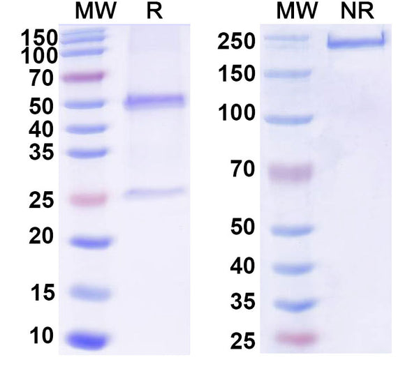 SDS-PAGE for Anti-DNA Antibody (MRL-4)