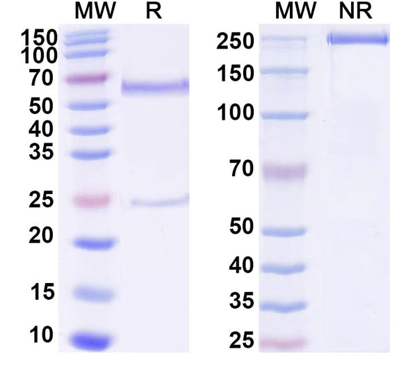 SDS-PAGE for Anti-DNA Antibody (BW9-13)