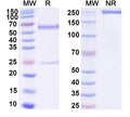 SDS-PAGE for Anti-DNA Antibody (BW9-9)