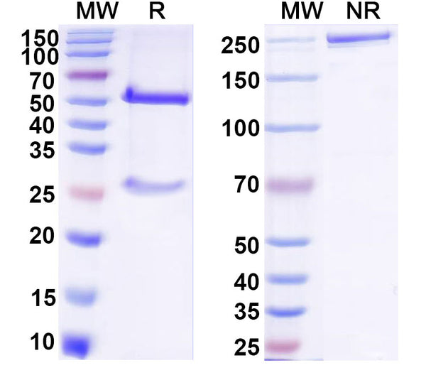 SDS-PAGE for Anti-DNA Antibody (bfd38)