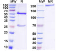 SDS-PAGE for Anti-DNA Antibody (F2-4)