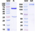 SDS-PAGE for Anti-DNA Antibody (F7-7)