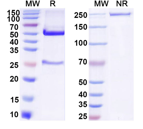 SDS-PAGE for Anti-DNA Antibody (F2-11)