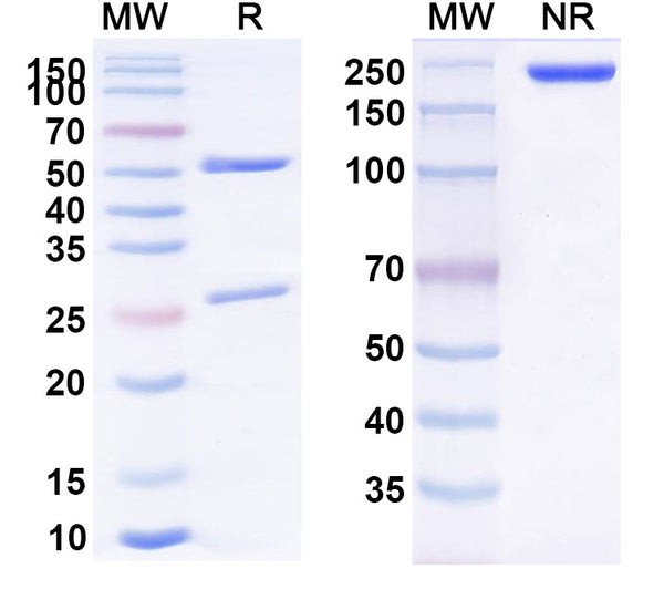 SDS-PAGE for Anti-6*His Tag (HHHHHH) Monoclonal Antibody (1A056)