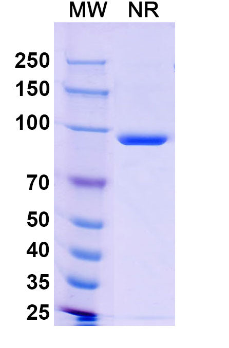 SDS-PAGE for Anti-6X His Tag (HHHHHH) Antibody (FY12)