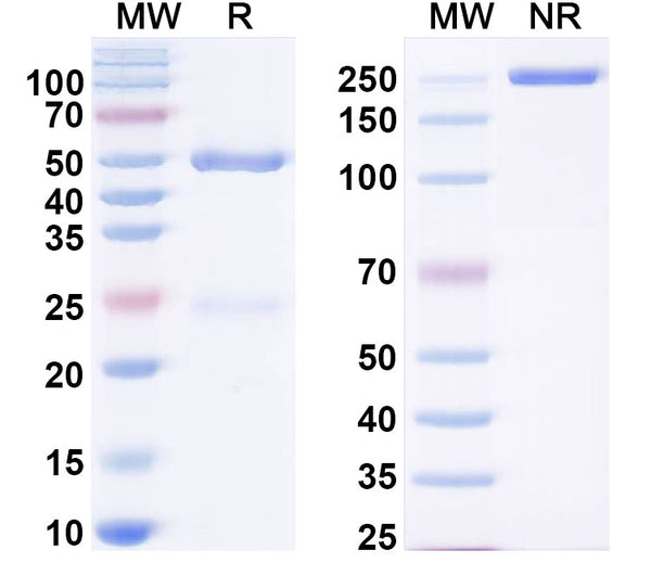 SDS-PAGE for Anti-GXM/glucuronoxylomannan Antibody (2H1).