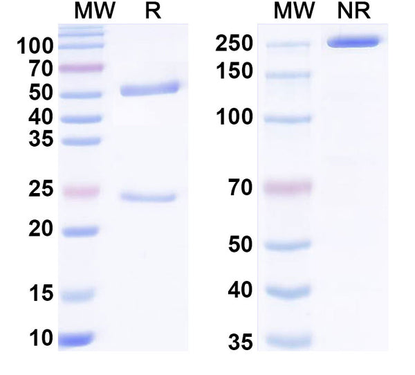 SDS-PAGE for Anti-G-quadruplex DNA Antibody (5E11#)