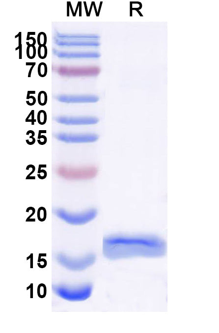 SDS-PAGE for Anti-DNA G-quadruplex Structures Nanobody (SG4)