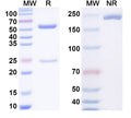 SDS-PAGE for Anti-Hairpin ssDNA Antibody (DNA-1).