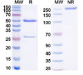 SDS-PAGE for Anti-Francisella tularensis O-polysaccharide/Ft O-antigen Antibody (SAA0497)