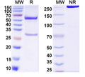 SDS-PAGE for Anti-DNA Antibody (16)