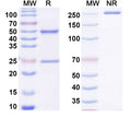 SDS-PAGE for Anti-dsDNA Antibody (3E10#).