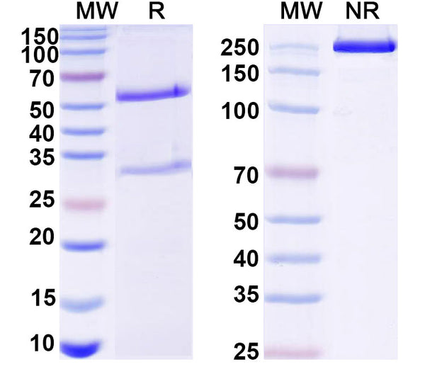SDS-PAGE for Anti-DNA Antibody (P17.79)