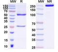 SDS-PAGE for Anti-DNA Antibody (P17.80)
