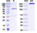 SDS-PAGE for Anti-DNA Antibody (202.54)