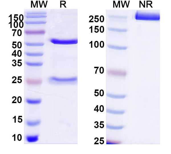SDS-PAGE for Anti-DNA Antibody (202.105)