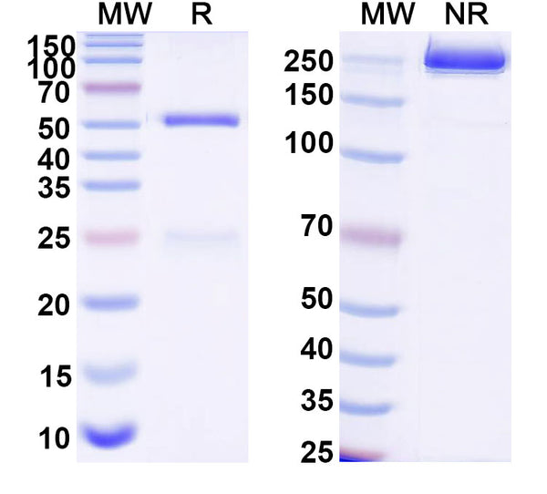 SDS-PAGE for Anti-DNA Antibody (17p.101)