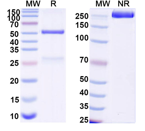 SDS-PAGE for Anti-DNA Antibody (17s.145)